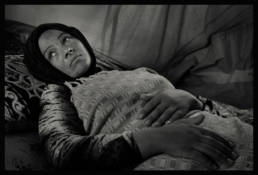 A Syrian woman requiring medical attention in an IDP camp. Idlib, Syria.